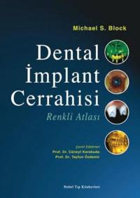 Dental İmplant Cerrahisi Renkli Atlası Kolektif