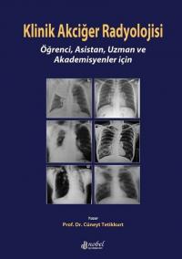 Klinik Akciğer Radyolojisi